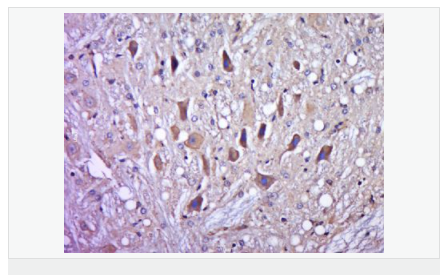 605996ecd3cd0.png image.png