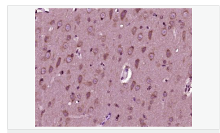 606bc85b45f9b.png image.png